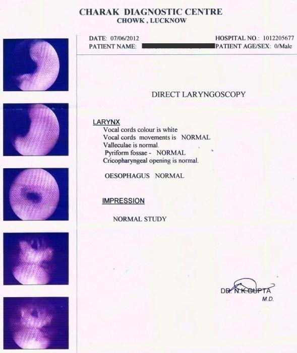 After the treatment 1